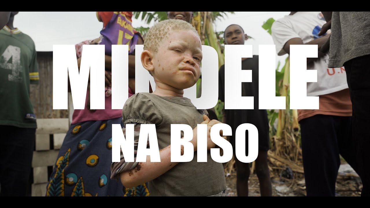 Mindele Na Biso : L'Albinisme en République Démocratique du Congo | Documentaire | Français | 2022
