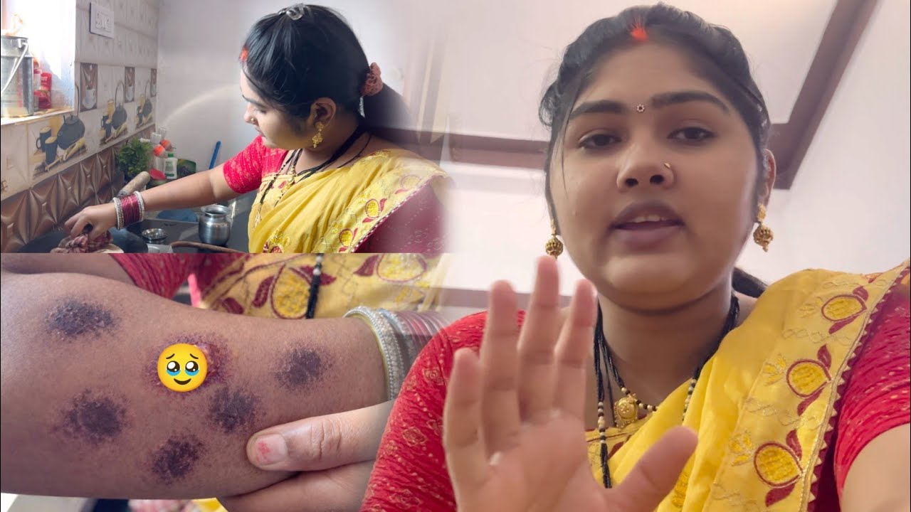 हाथ जल गया 🥹🥲 || My Daily Vlog - 02