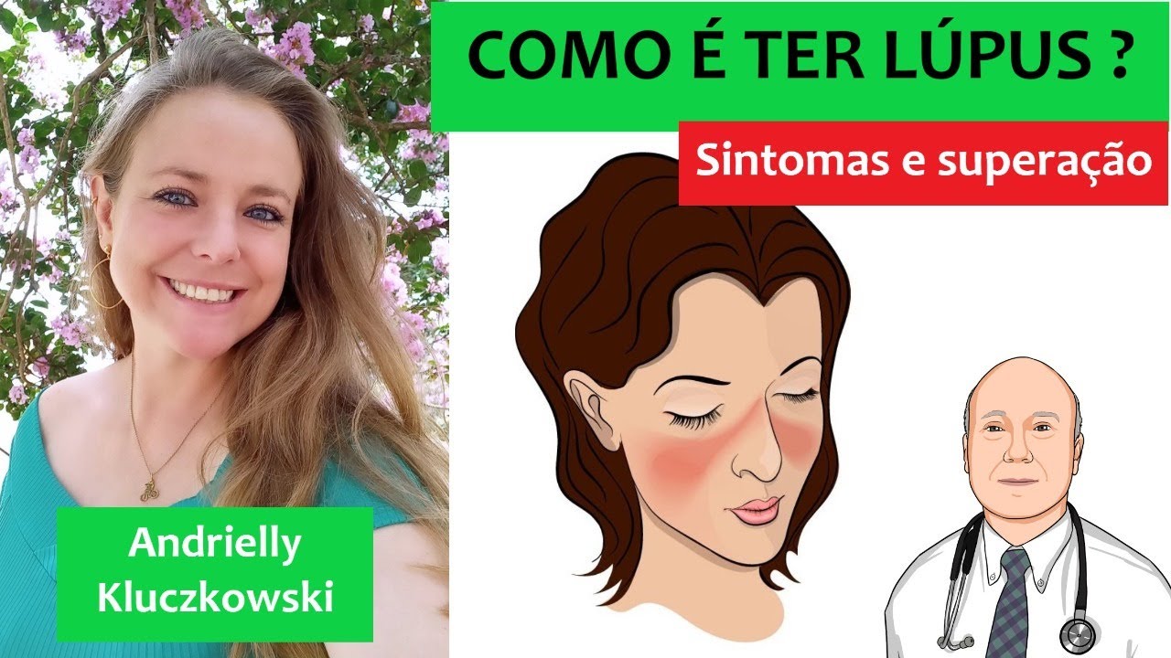 Histórias de superação de quem tem lúpus eritematoso sistêmico