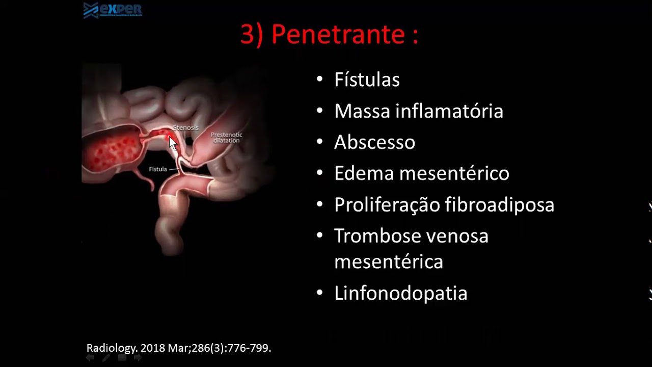 Entero RM/TC