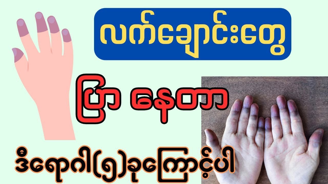 လက်ချောင်းတွေ ပြာနေတာ ဒီရောဂါ(5)ခုကြောင့်ပါ။