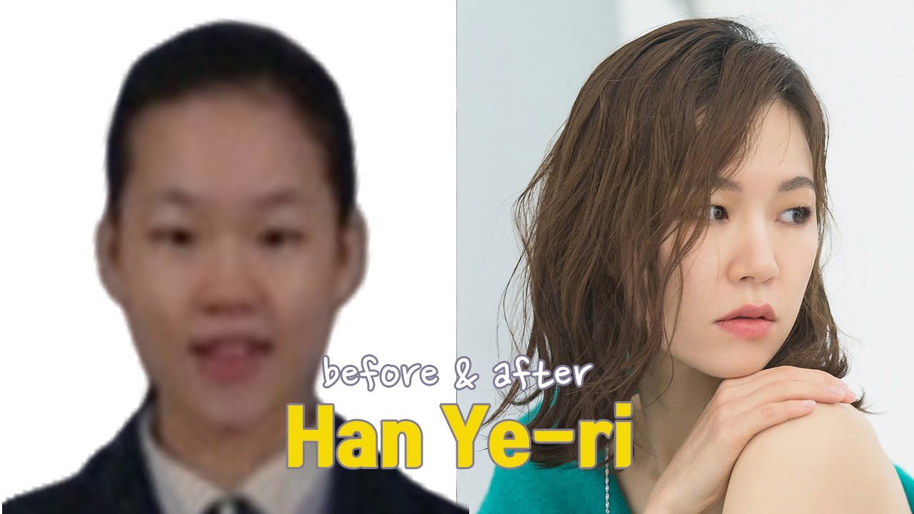 Han Ye-ri before and after