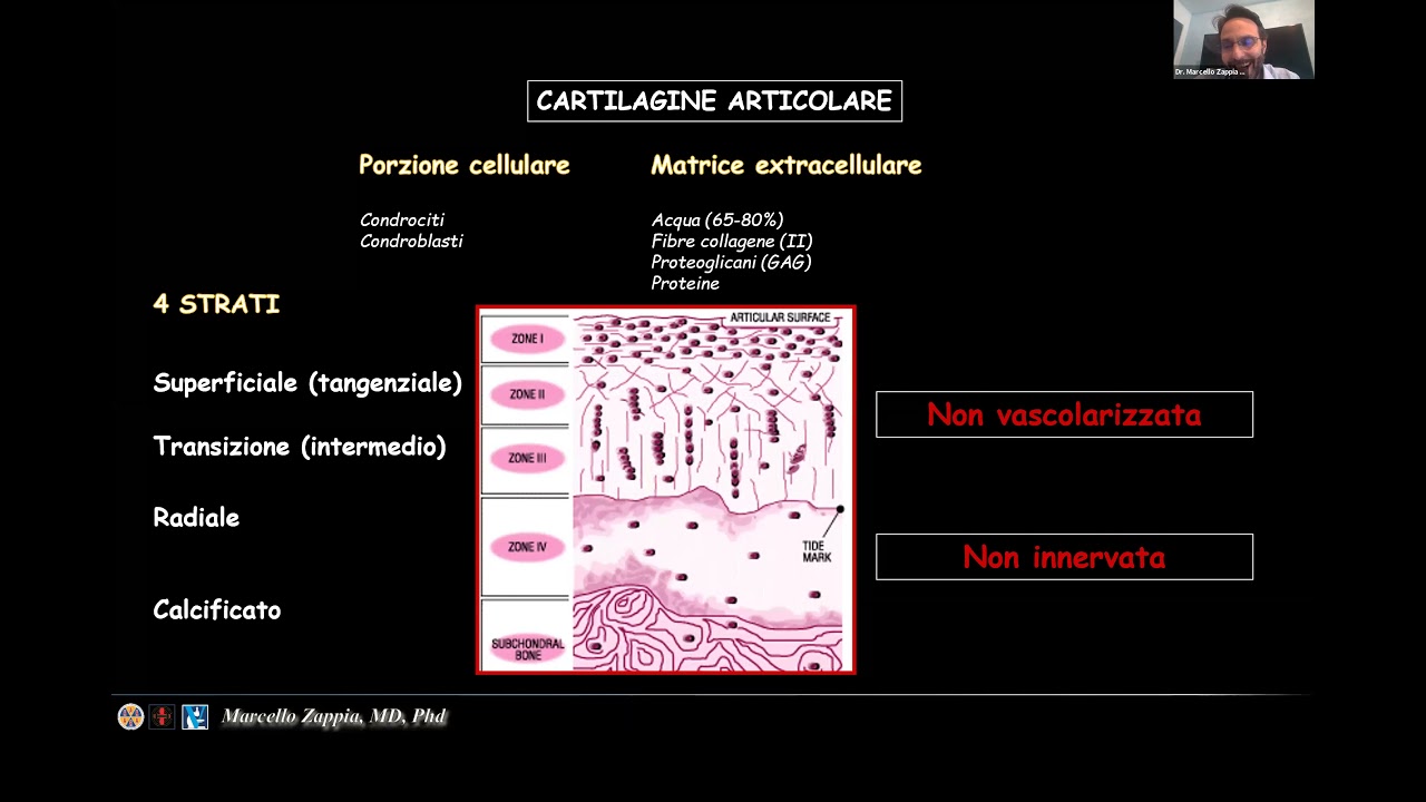 30 minuti con… Marcello Zappia: Update in imaging nell'artrosi di ginocchio