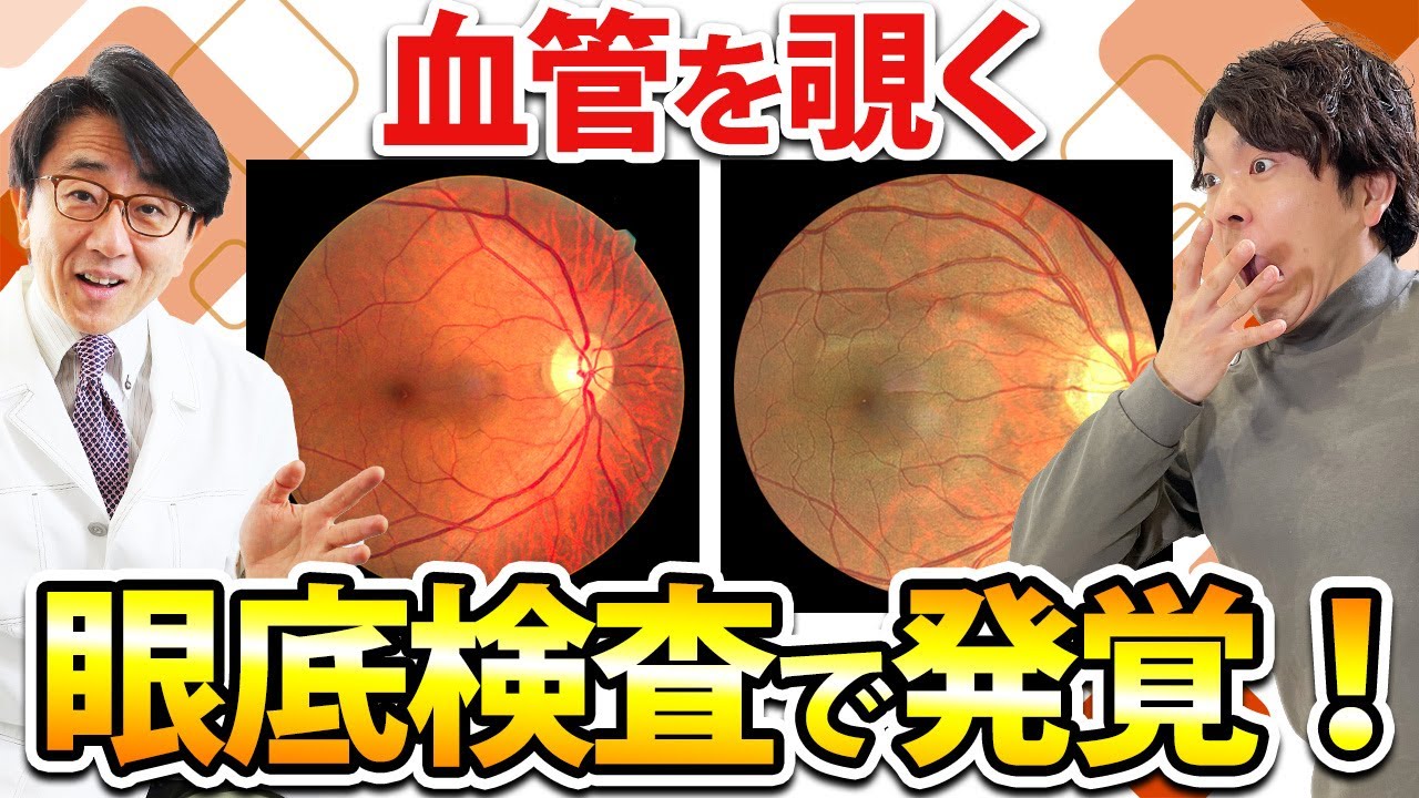 ショック！眼底検査で見つかる怖い病気！高血圧、動脈硬化、糖尿病、脳の病変！？