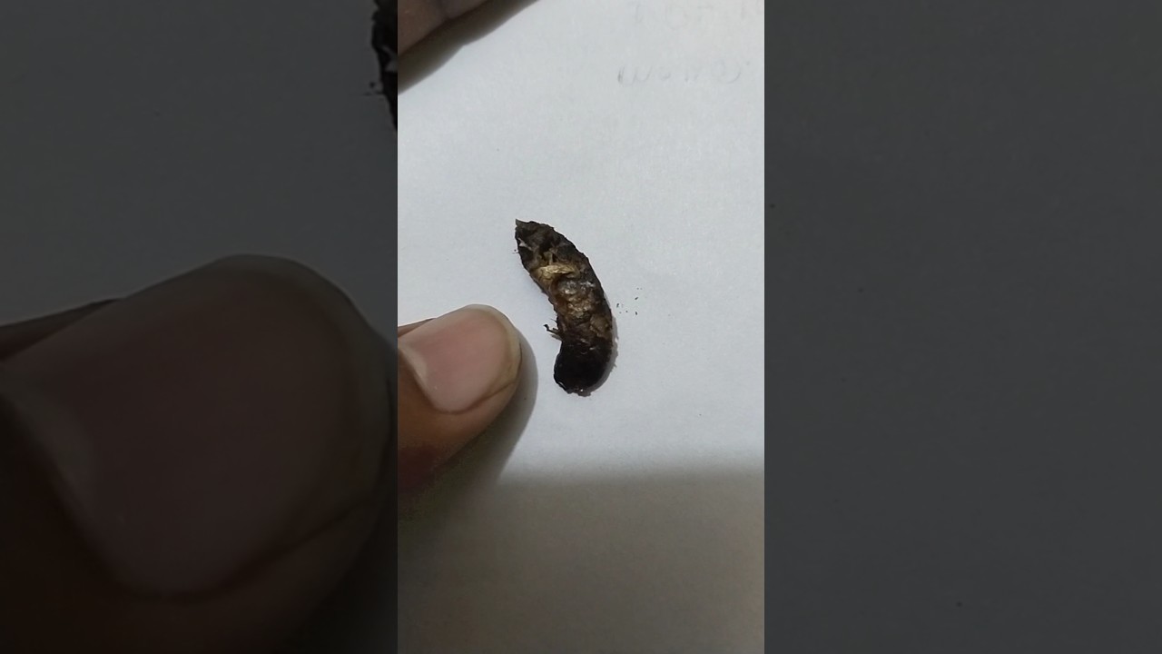 मेरे कान से ये क्या निकला 😲😲 