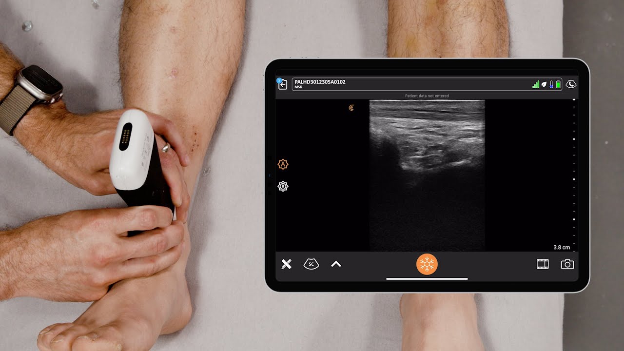 Ultrasound of the Ankle