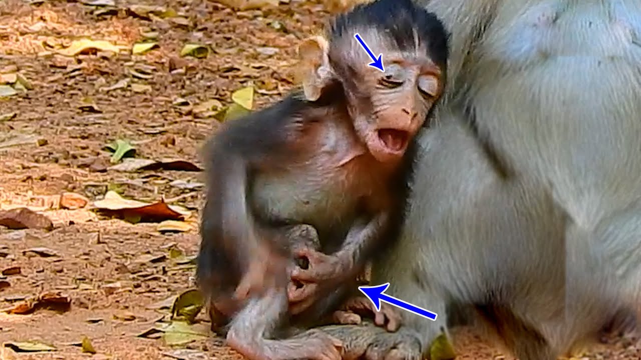 Eye And Leg Pain Make Baby Anissa Painful | Anissa Cries Near Mum Anna Need Care