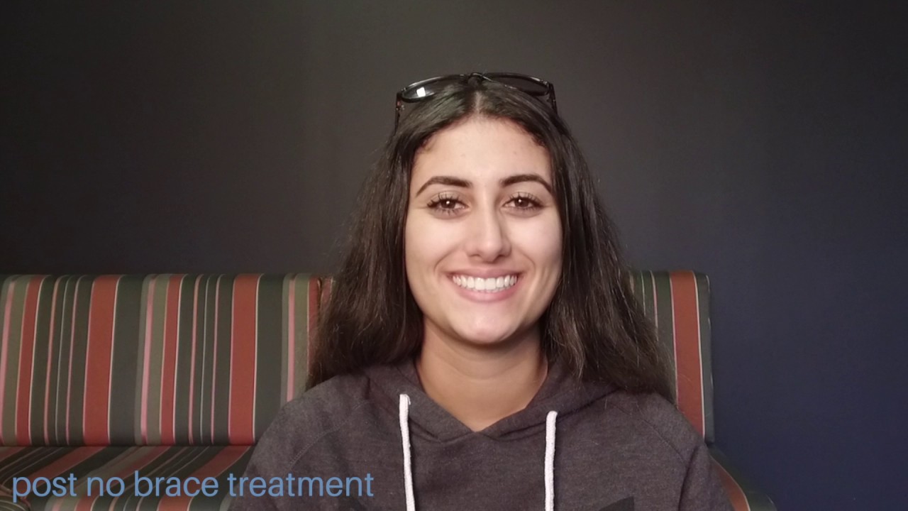 No extractions - No braces