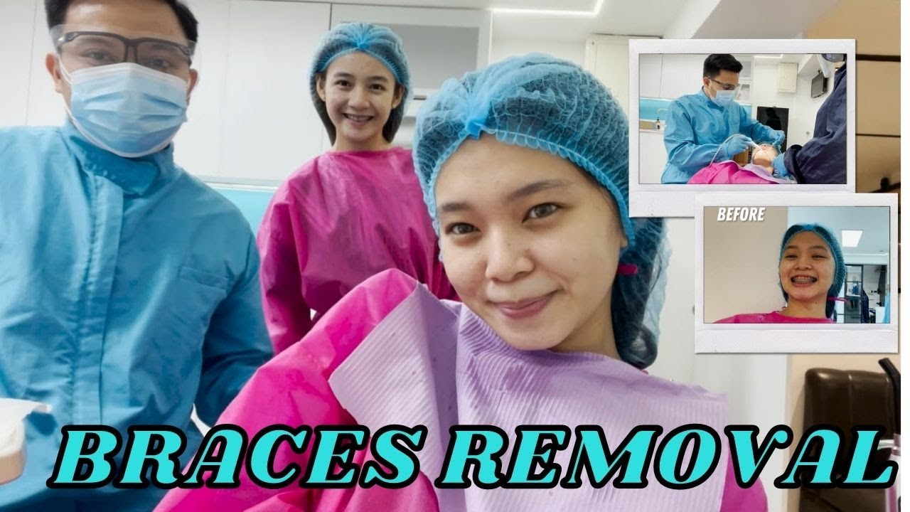 Braces Removal | Pauline Bianca Santos