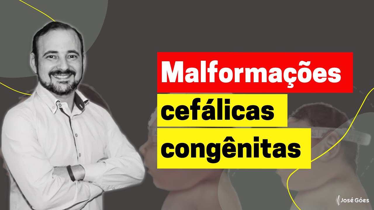 Malformações cefálicas congênitas | José Góes