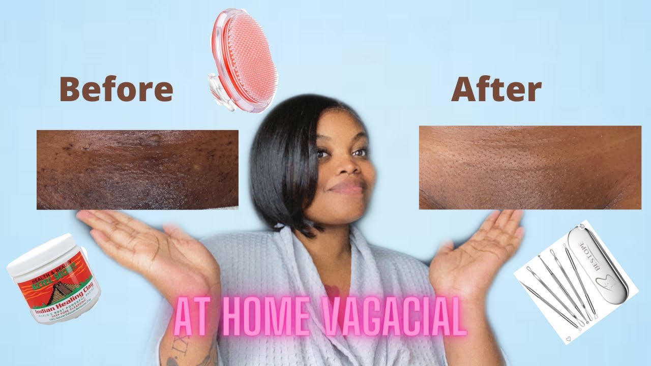 🌸AT HOME VAGACIAL🌸 | GET RID OF INGROWN HAIRS | BYEBYE HYPERPIGMENTATION