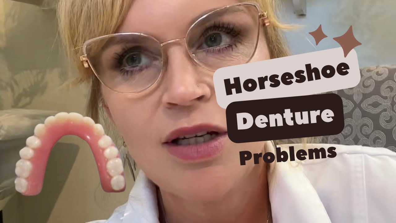 Horshoeing the Upper Denture, Expert Opinion