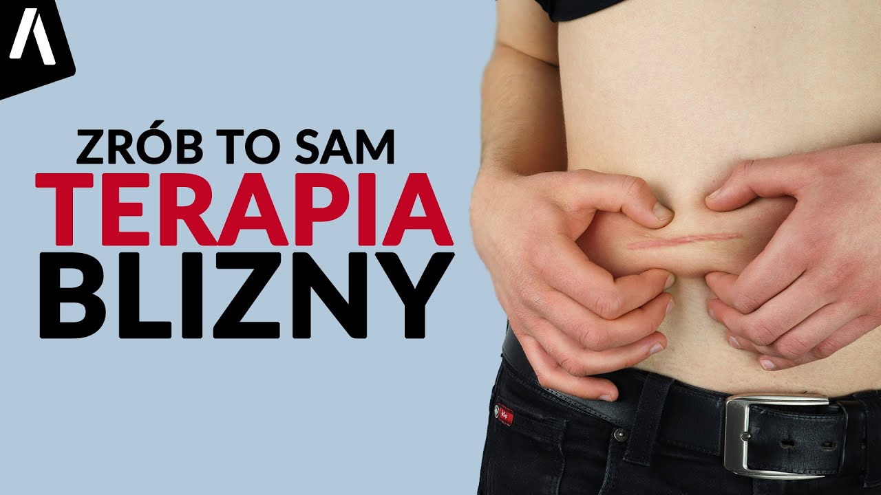 Terapia blizny I Wszystko co musisz wiedzieć