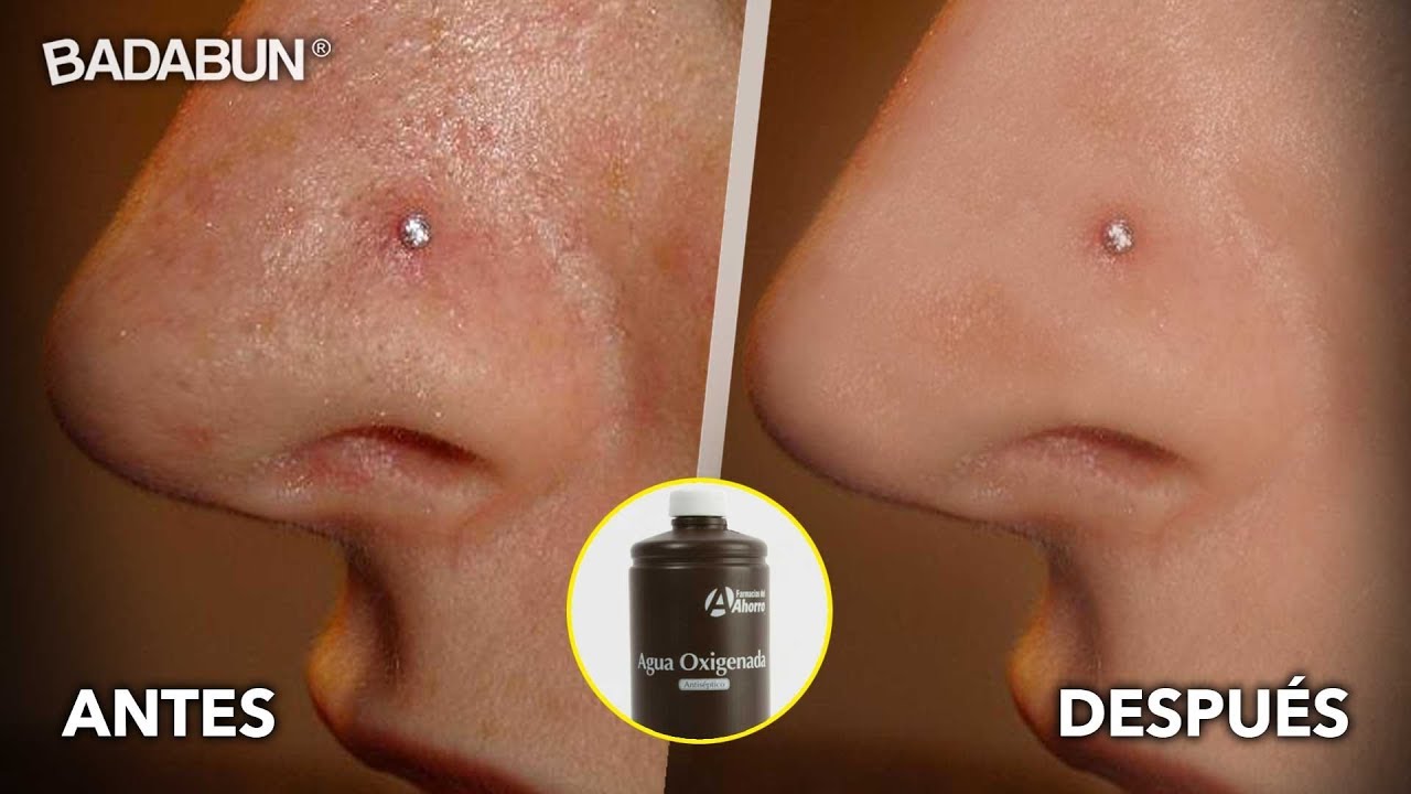 6 Trucos con agua oxigenada. Lucirás genial