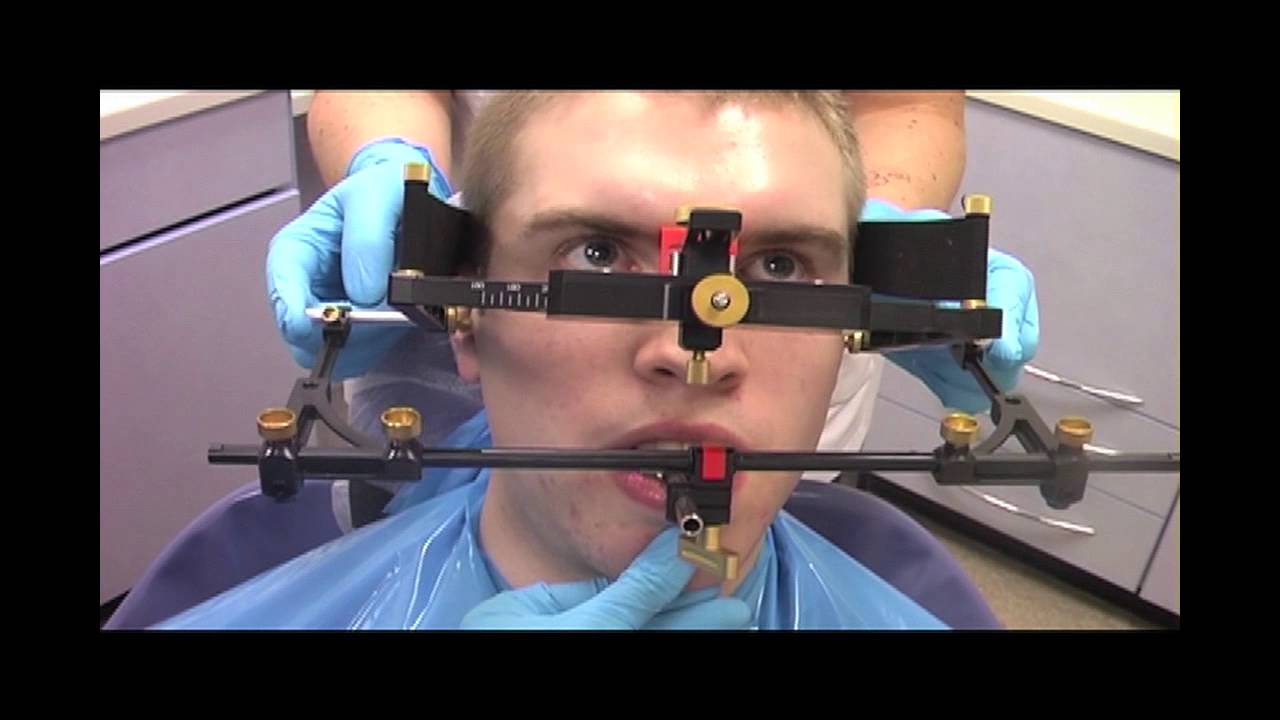 Using Denar Cadiax Pantograph