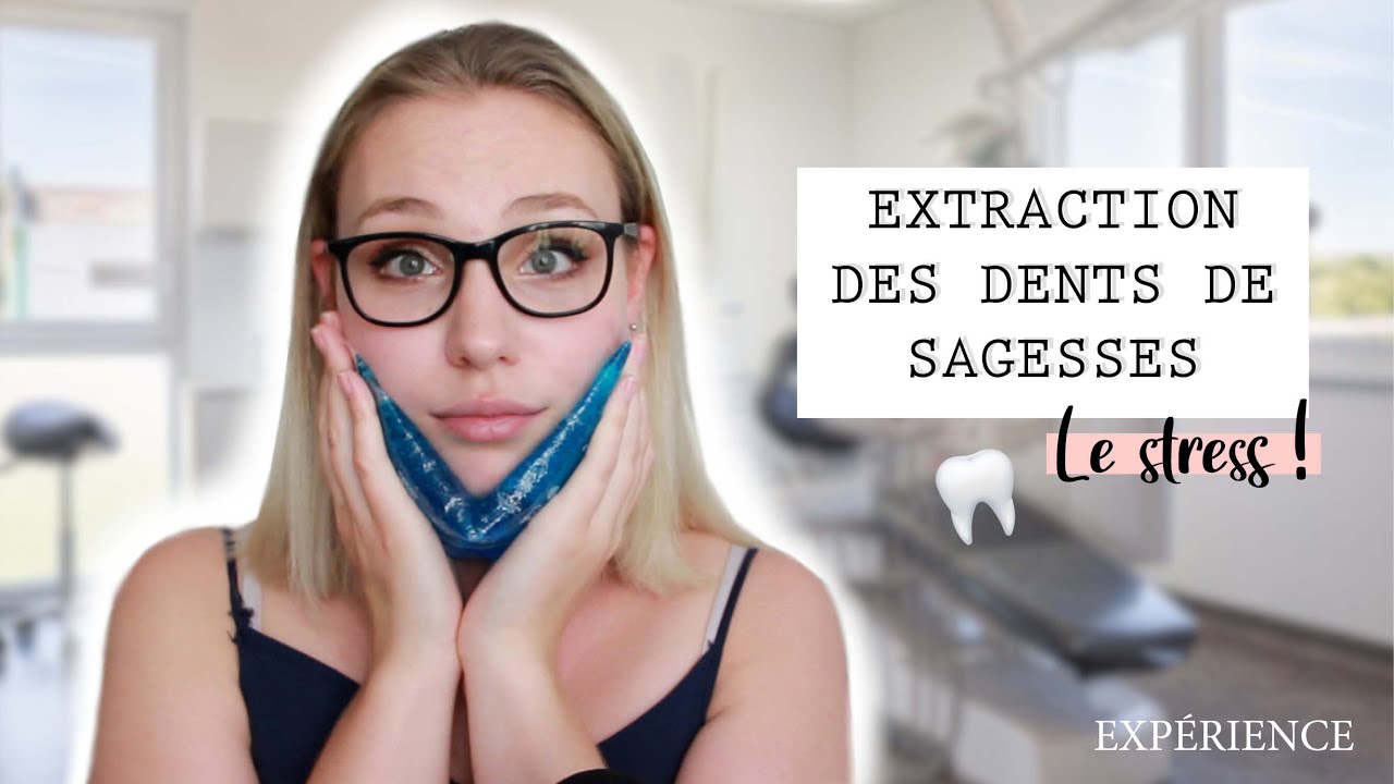 Opération des dents de sagesses [Story Time] | Romanna