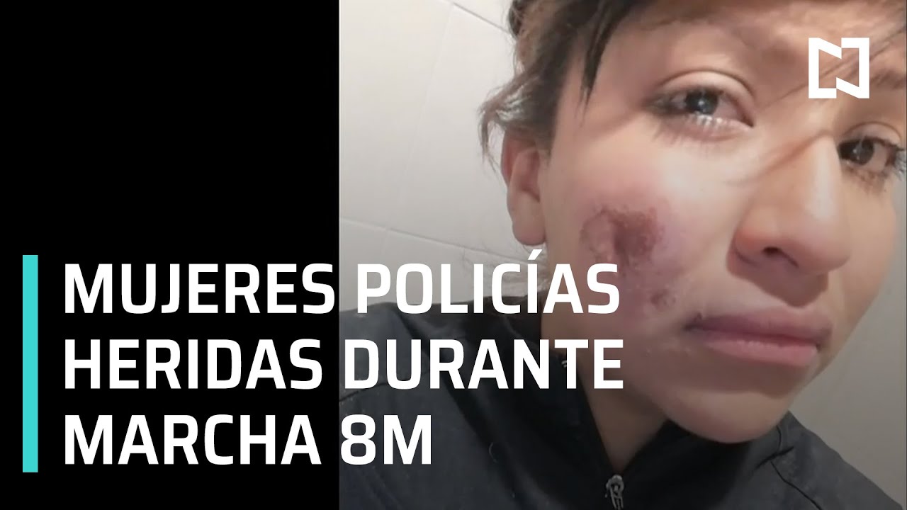 Mujeres policías lesionadas durante marcha feminista del 8M - En Punto