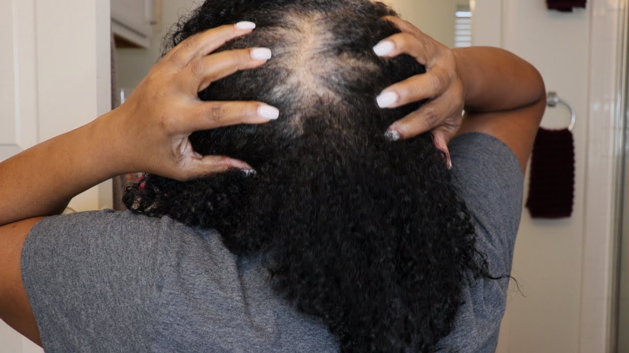 Chit Chat on thinning hair/wash day using The Doux