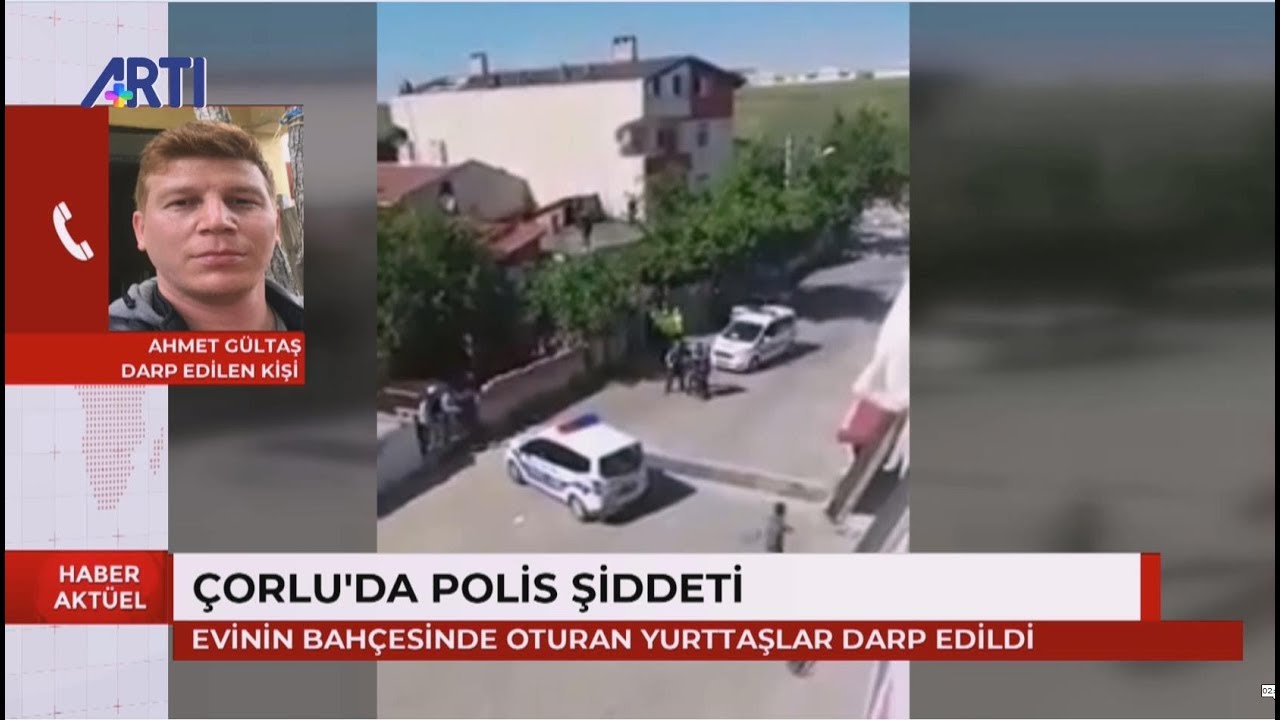 Çorlu'da polis şiddetine maruz kalan Ahmet Gültaş yaşadıklarını anlatıyor