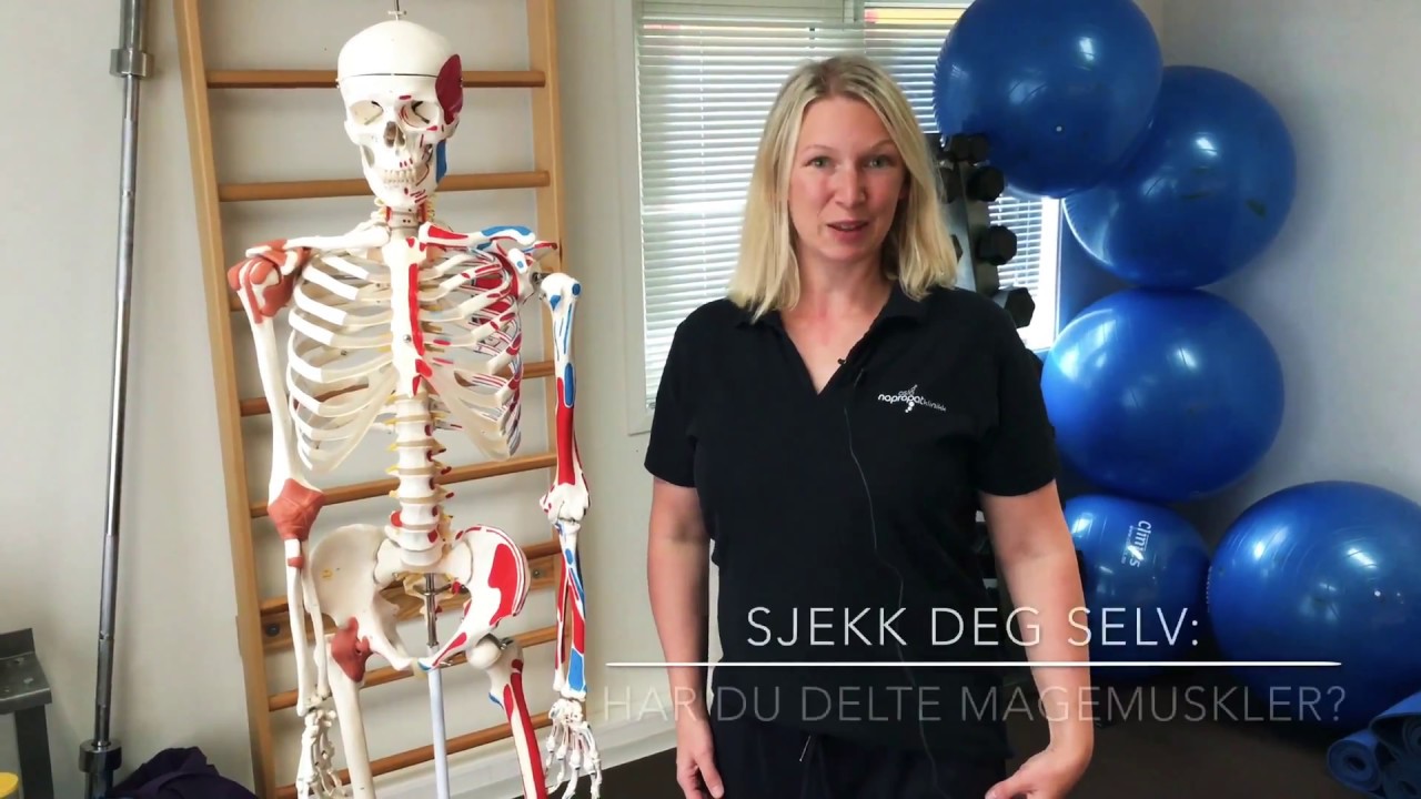 Sjekk om du har delte magemuskler (diastase)