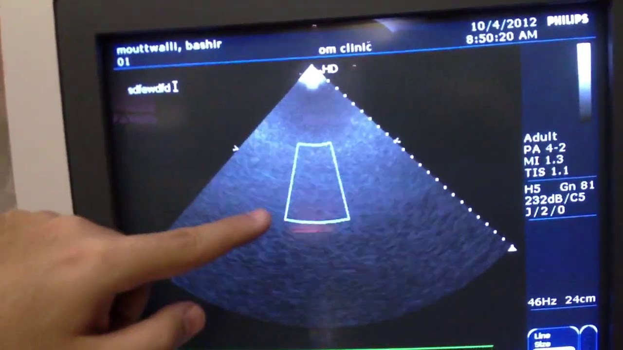 Envisor ٥ الصورة الثنائية البعد المعايرة المتقدمة