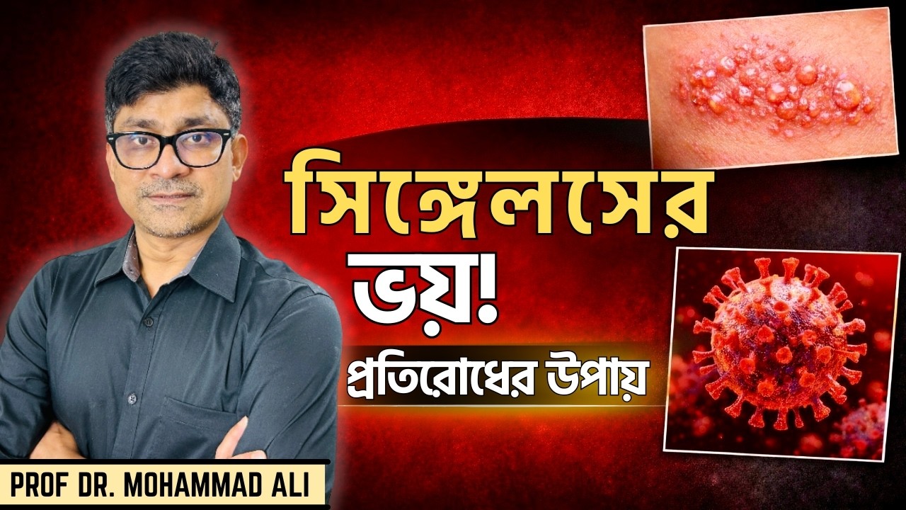 শিঙ্গেলস কী? কেন ৫০ বছরের পর এই রোগের ঝুঁকি বেশি