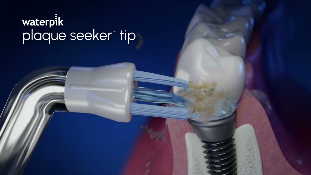 Waterpik&trade; Plaque Seeker&trade; Tip