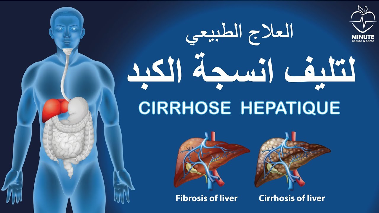 العلاج الطبيعي لتليف الكبد ||  cirrhose hépatique