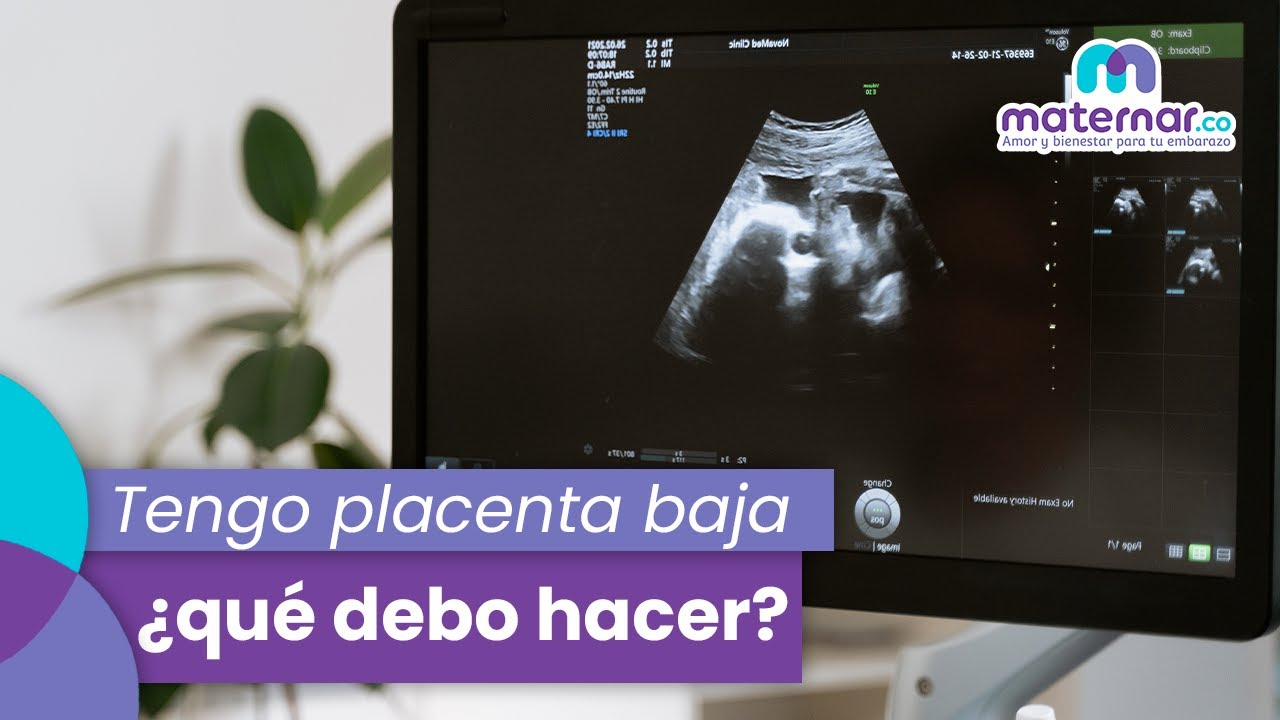 Tengo placenta baja: ¿Qué debo hacer? | Maternar.co