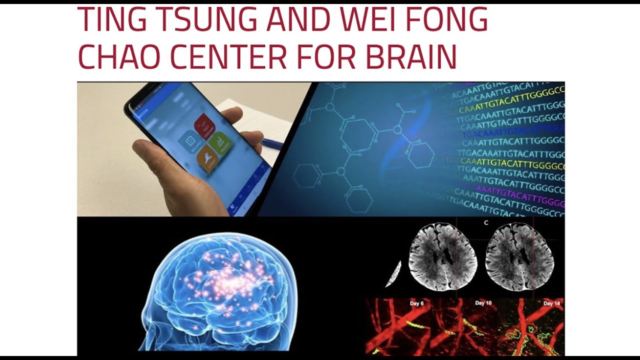 AI in Early Detection and Diagnosis of Acute Stroke (Stephen T. C. Wong)