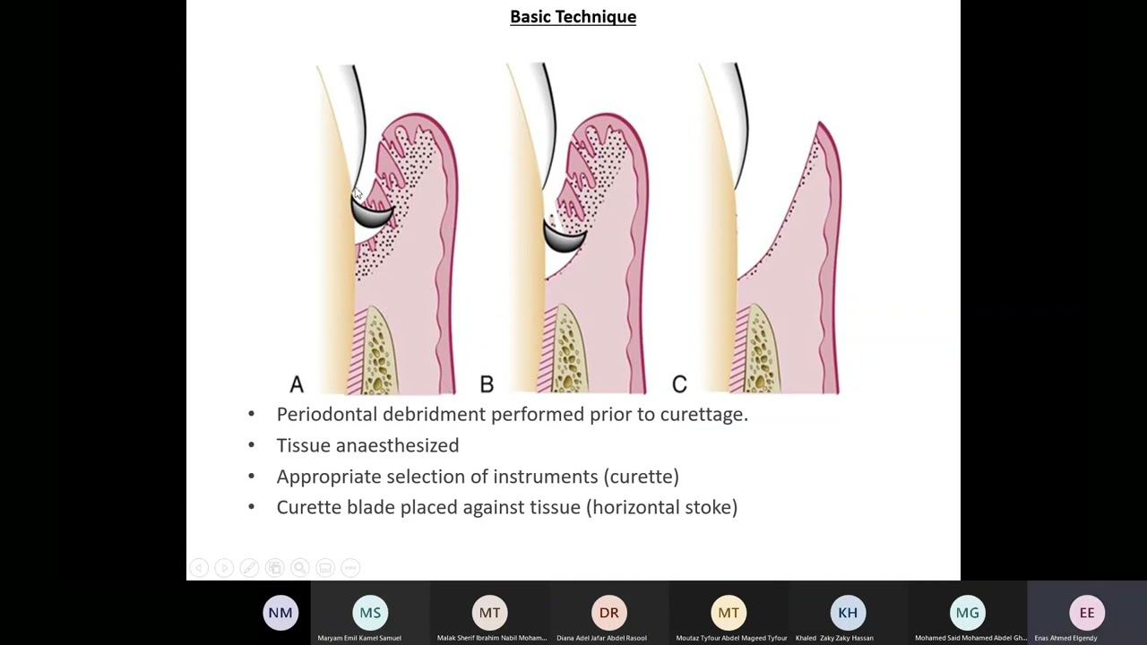 Gingival surgical techniques   Dr Enas Elgendy