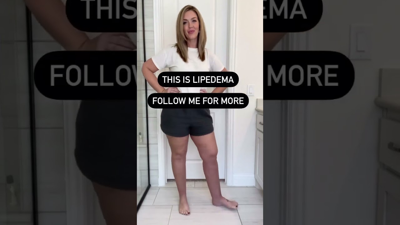 Lipedema Awareness