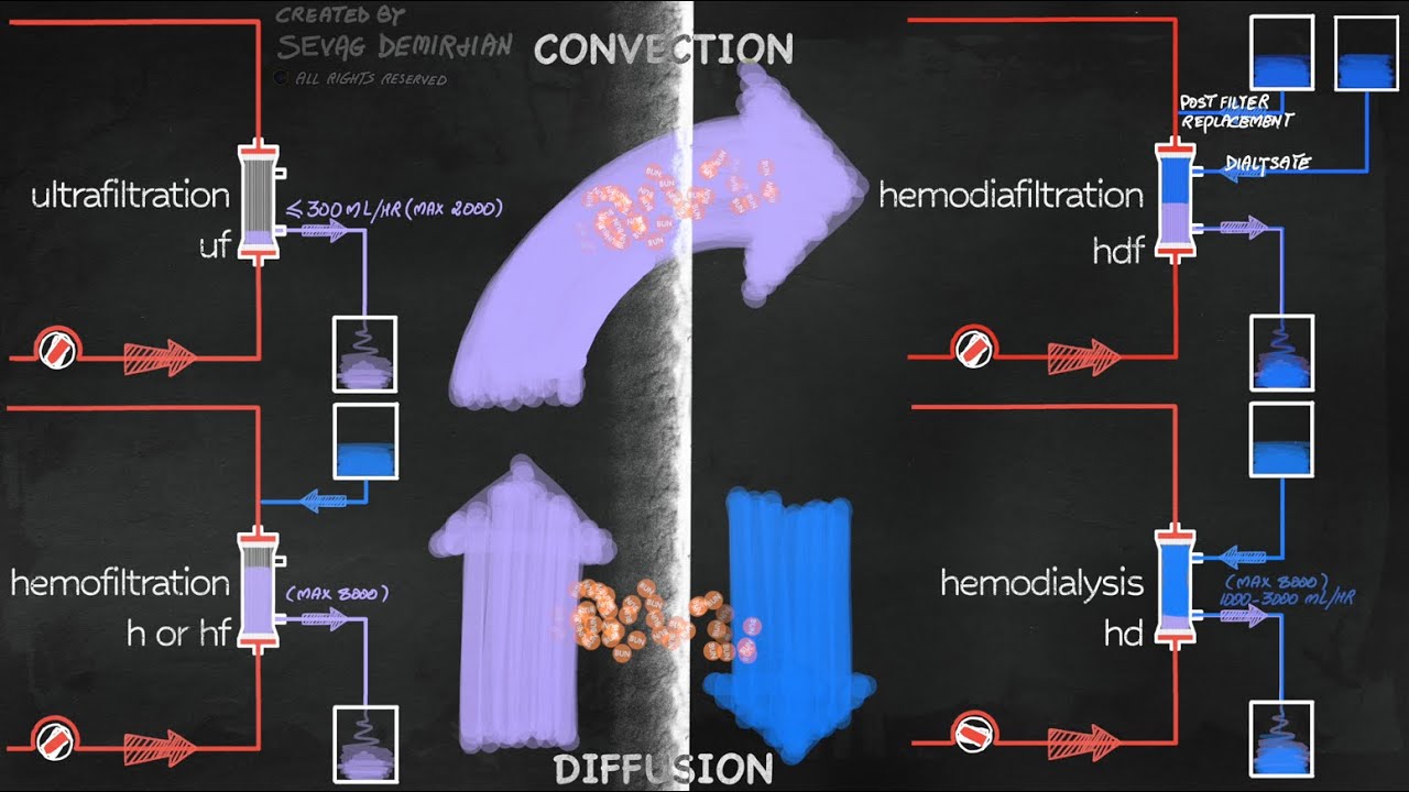 how does dialysis work? diffusion & convection explained