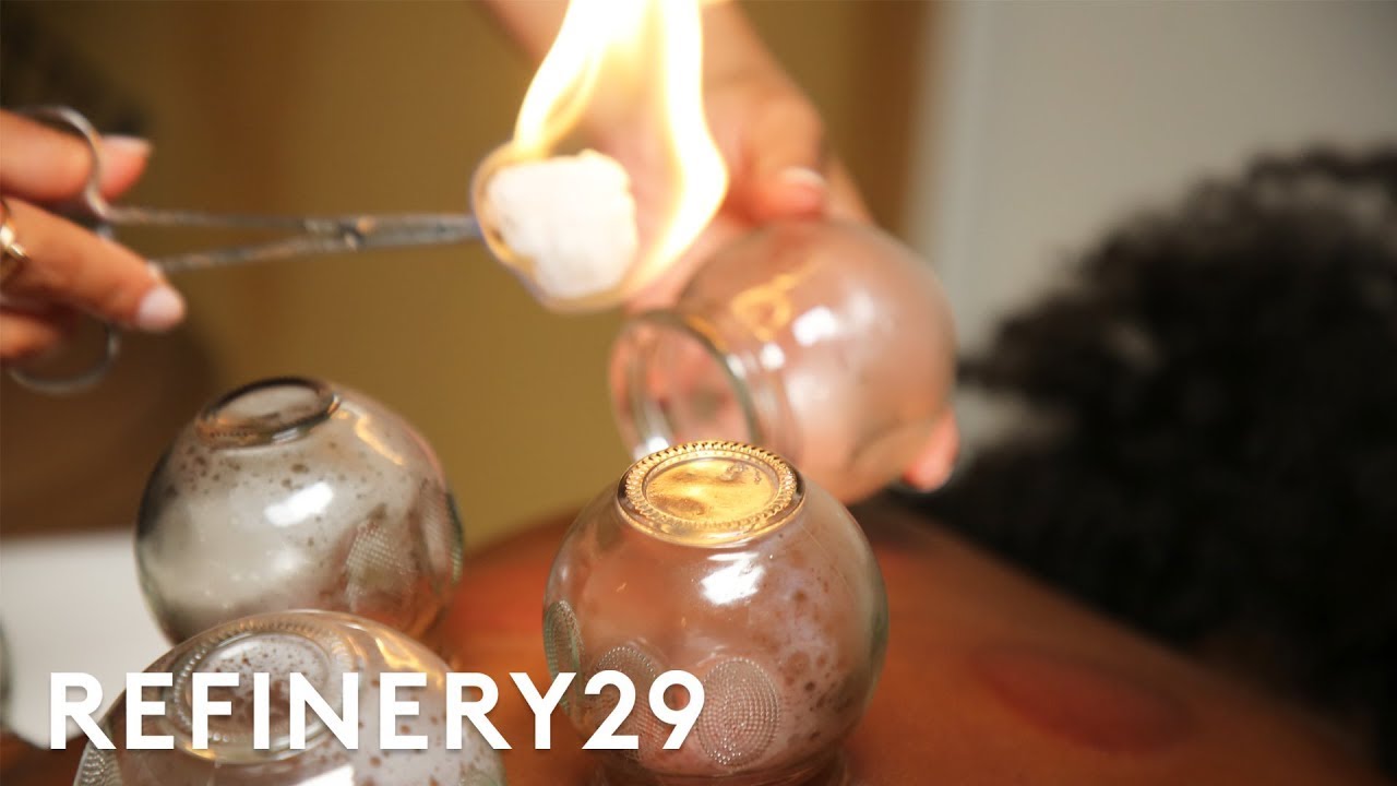 I Tried Cupping Therapy | Macro Beauty | Refinery29