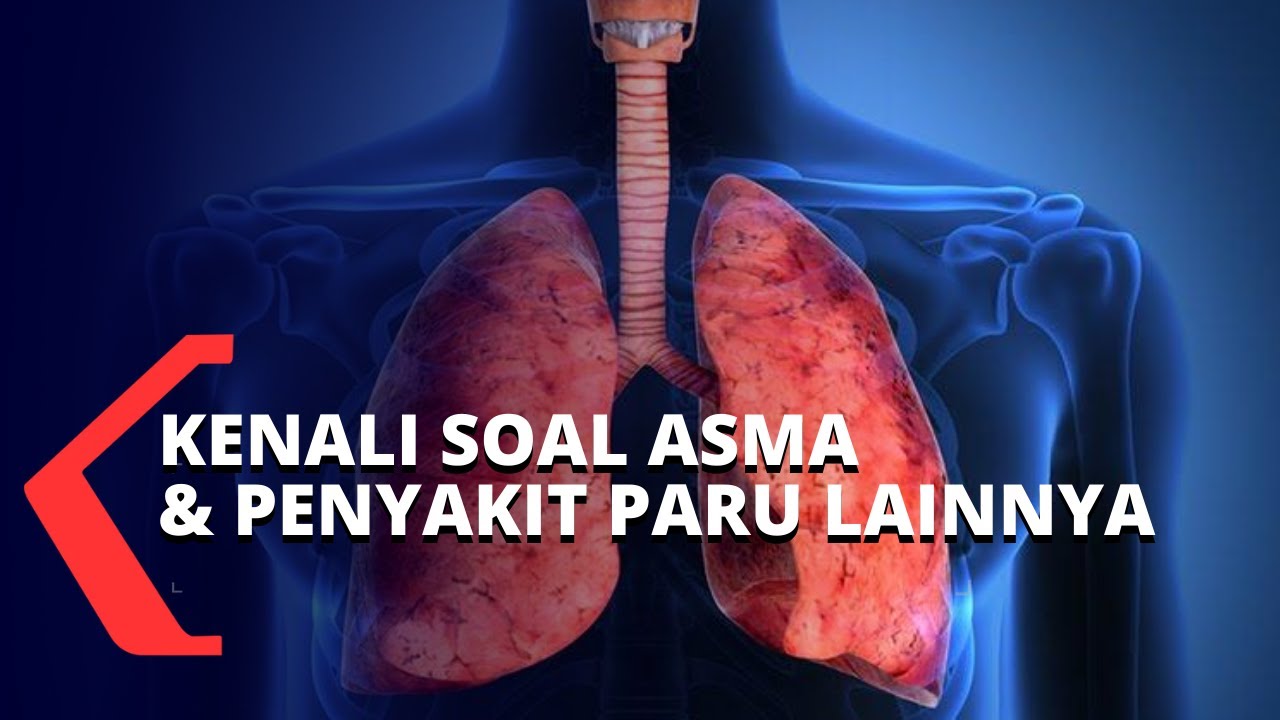 Kenali Lebih Jauh Terkait Asma, Sesak Napas dan Gejala Penyakit Paru Lainnya