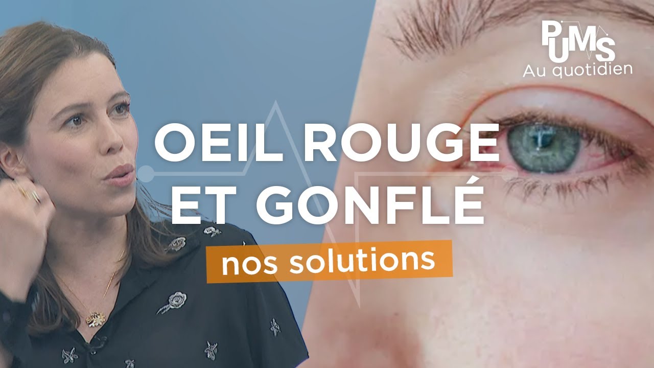 SOULAGEZ VOS YEUX ! Conseils de l'Ophtalmo du collège de PUMS contre la CONJONCTIVITE ALLERGIQUE 👁️