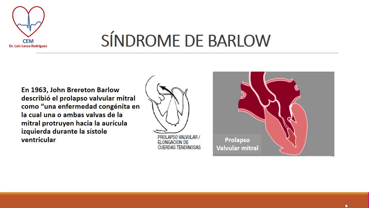 Insuficiencia mitral
