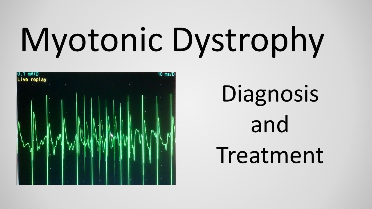 Myotonic Dystrophy Diagnosis and Treatment explained