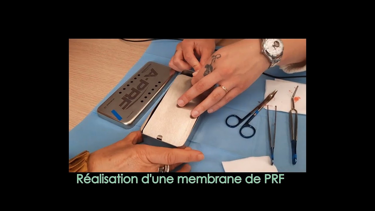 Retour en image - Circuit complet implantologie