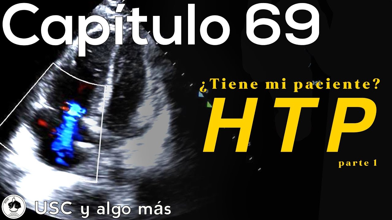 Capítulo 69:  ¿Tiene mi paciente Hipertensión Pulmonar?