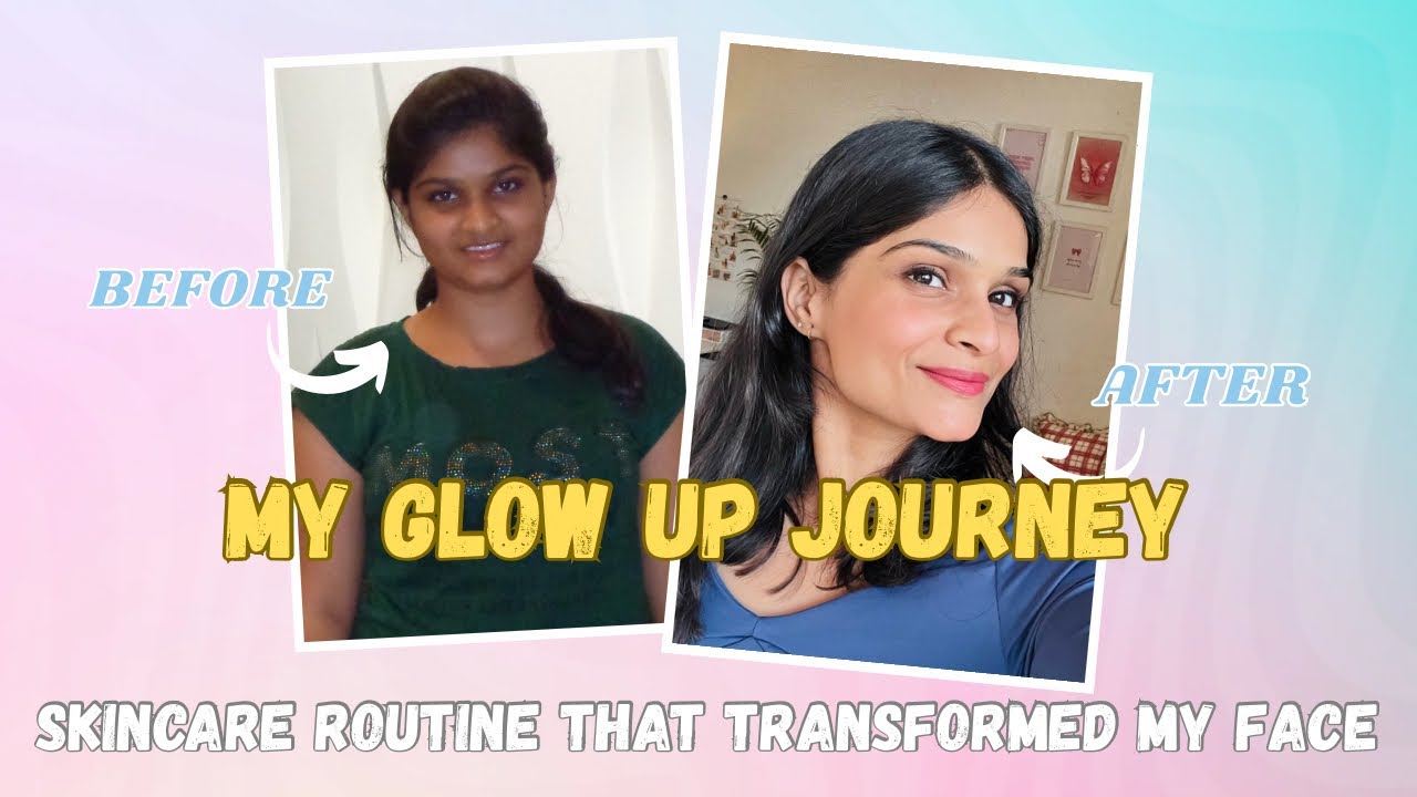 Routine for guaranteed skin glow up | My Honest Skincare + Diet Glow-Up Story