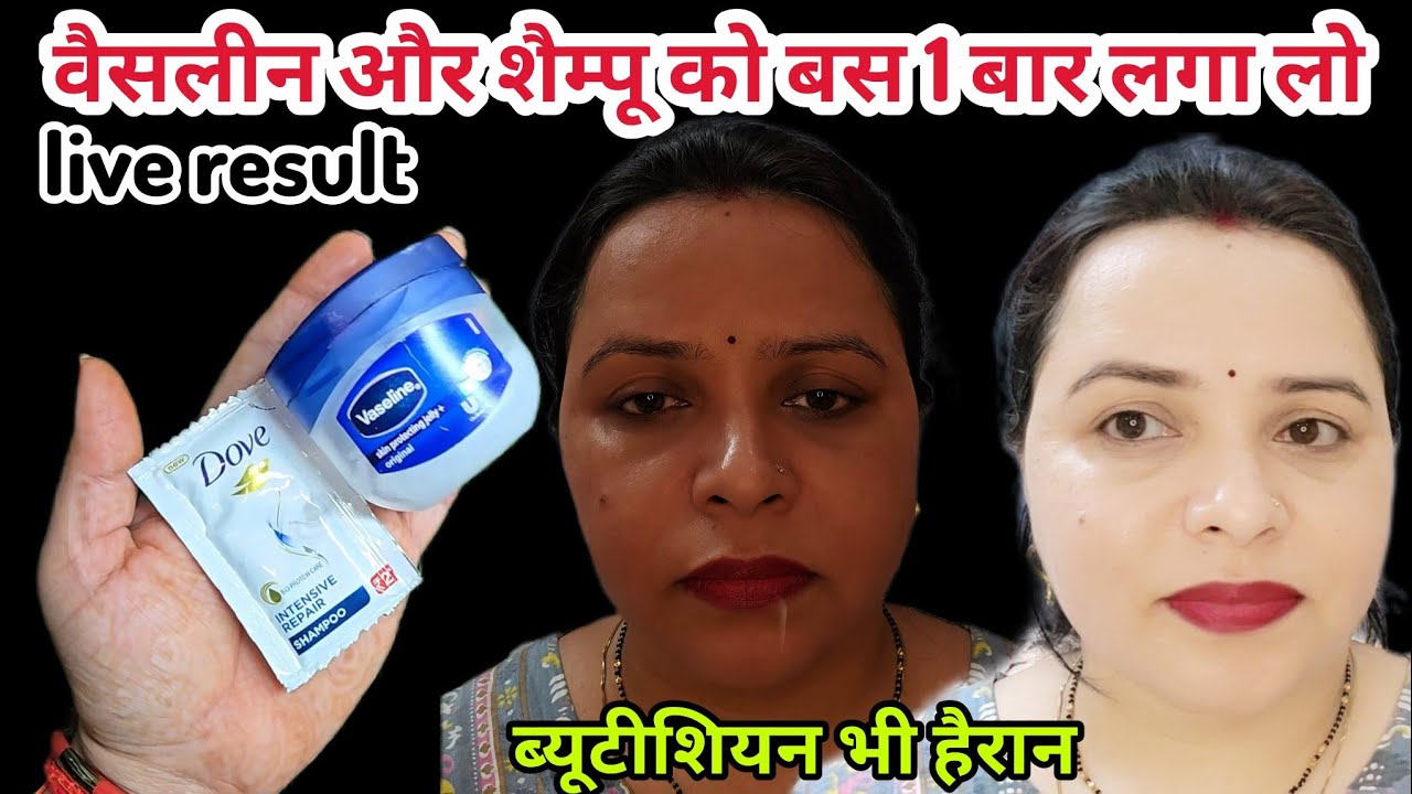 इस तरह से अपने चेहरे पर वैसलीन लगाएं और आपका चेहरा इतना गोरा हो जाएगा कि हर कोई देखेगा