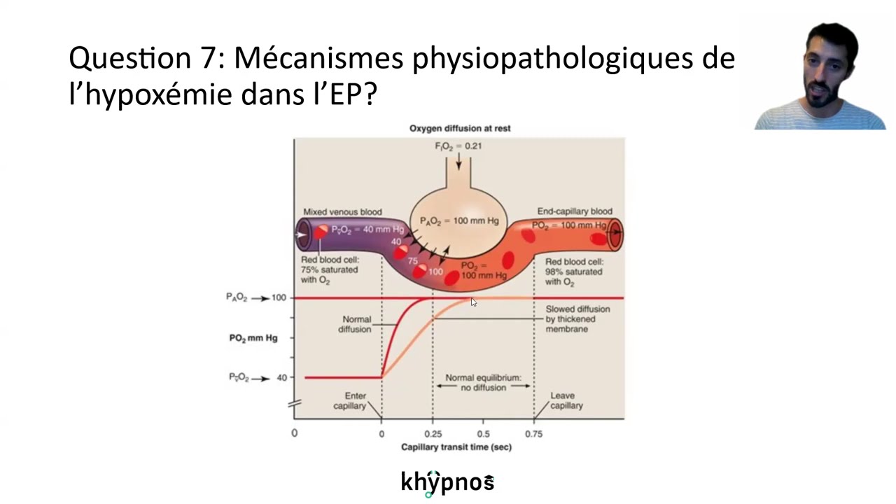 Khypnos : Embolie pulmonaire physiopathologie et gravité
