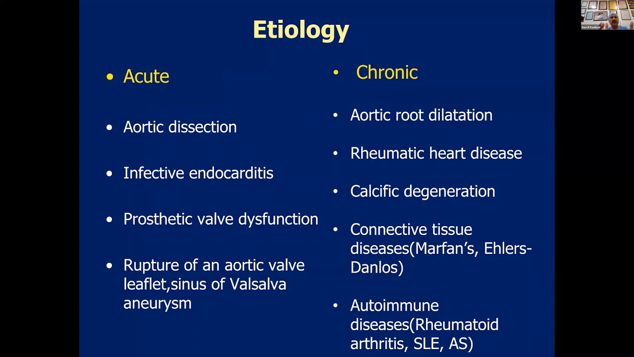 Philips Echo Webinar Series Echo Assessment of Aortic Regurgitation by Dr  R R  Kasliwal, Medanta, G