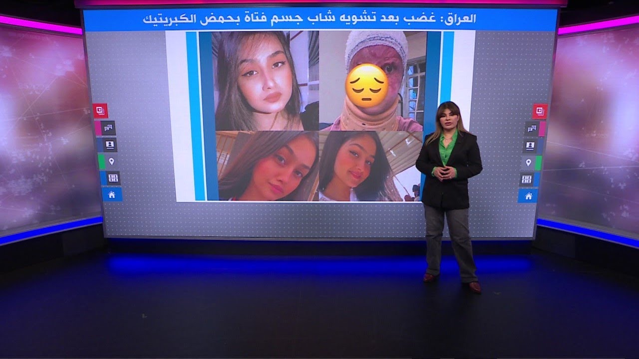 رفضت الزواج منه فشوه جسدها..جريمة 