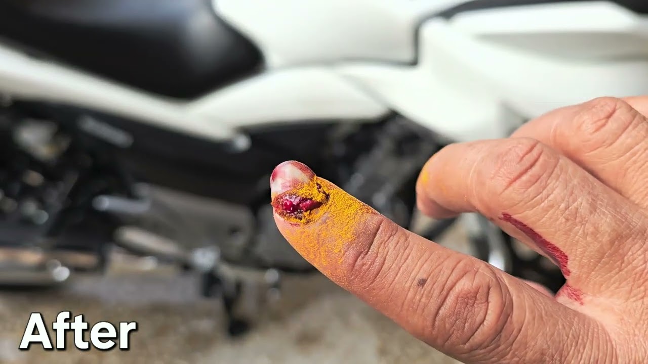 Suzuki Inazuma Aegis 250cc, Sad incident from no where