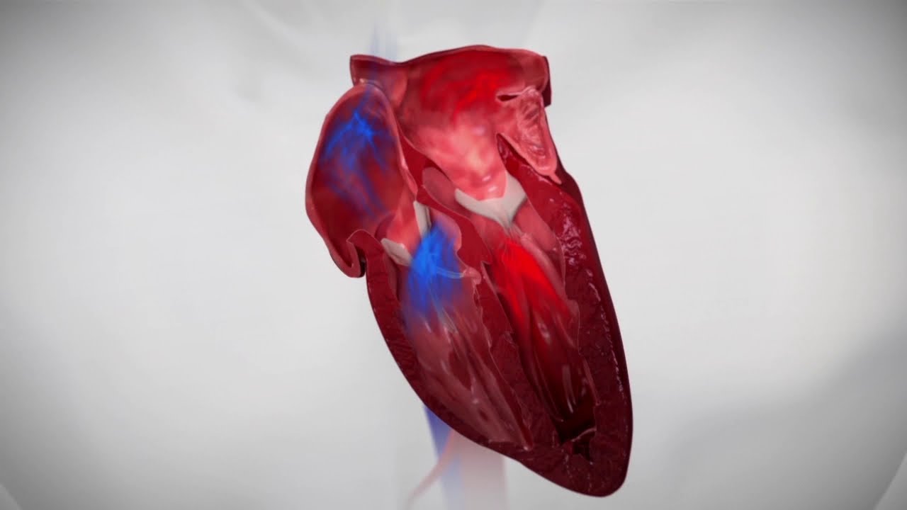 Corvia&reg; Atrial Shunt Animation
