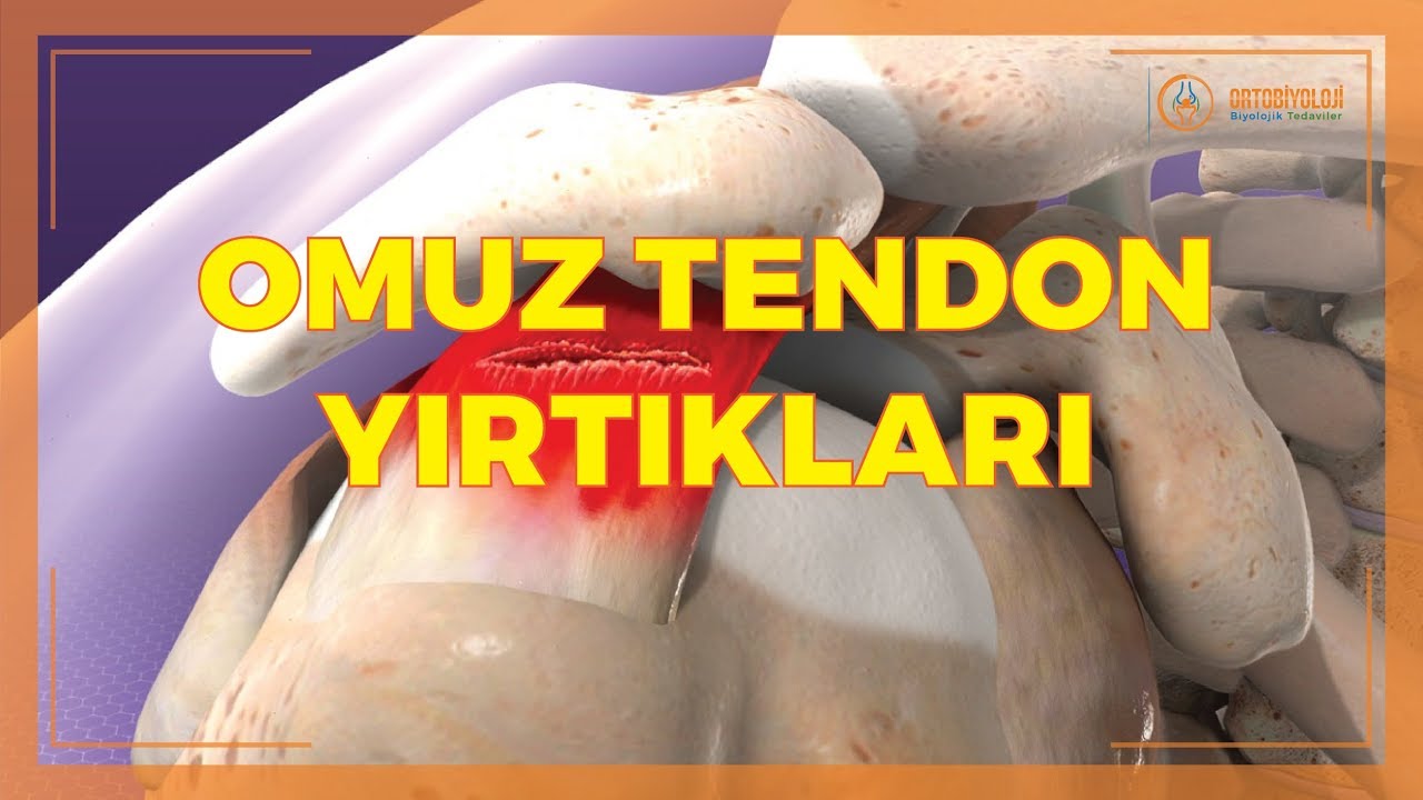 OMUZ BÖLGESİ TENDON YIRTIKLARI