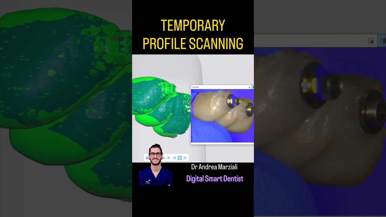 TEMPORARY SCANNING & AI! Thanks medit! 