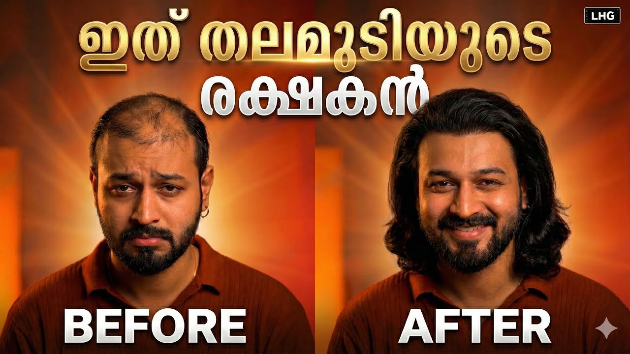 മുടി കൊഴിയില്ലാ 😱 Best tips to stop hair loss & hair growth 🔥